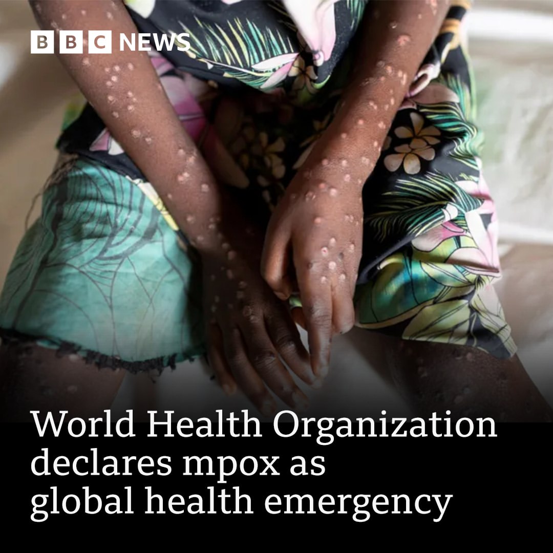 WHO Umumkan Darurat Kesehatan Global untuk Wabah Mpox di Afrika