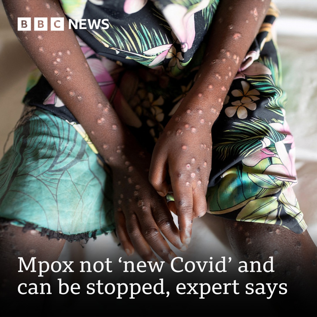 WHO: Kita Dapat Mengatasi Mpox Bersama-sama