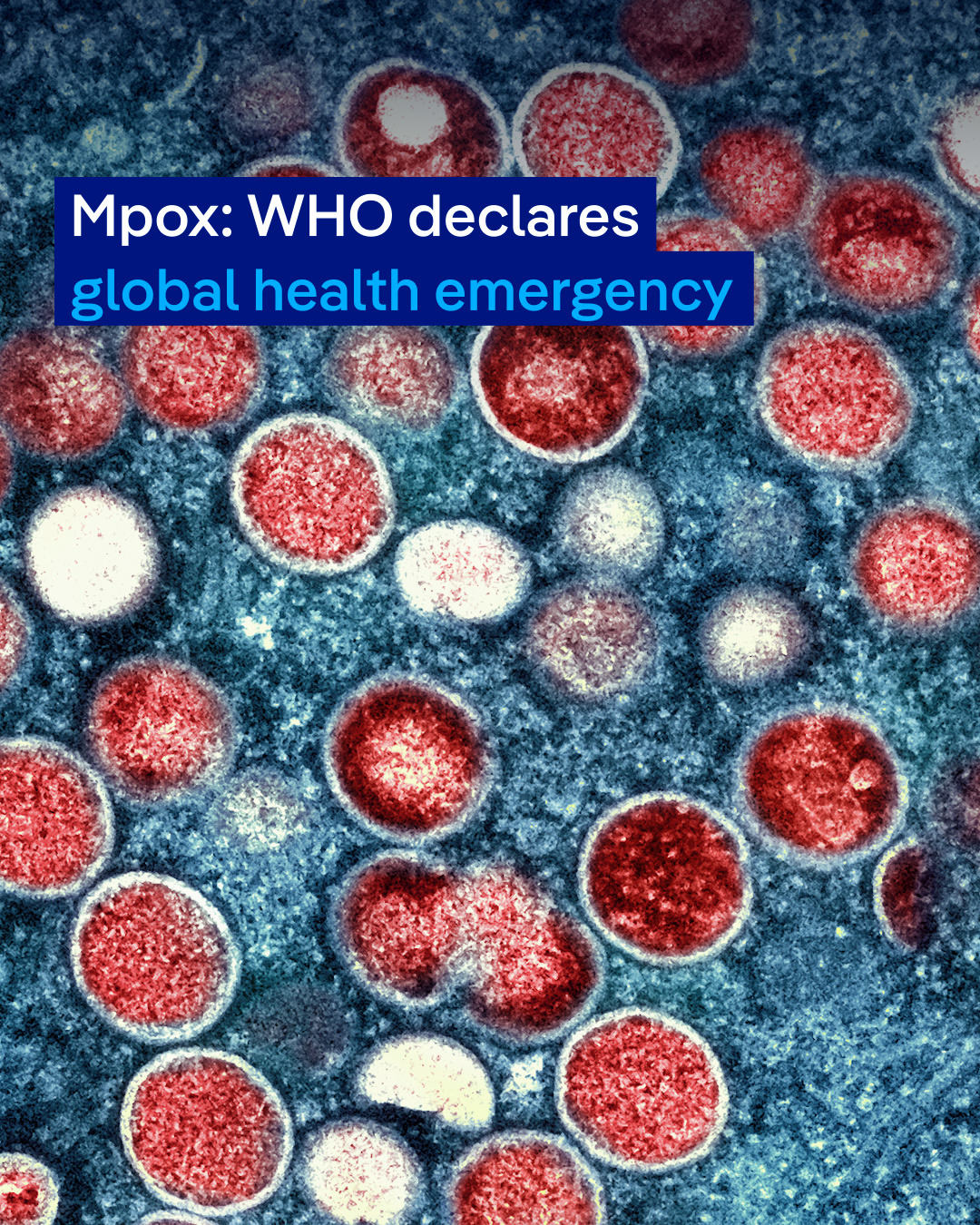 Organisasi Kesehatan Dunia Umumkan Mpox sebagai Darurat Kesehatan Global