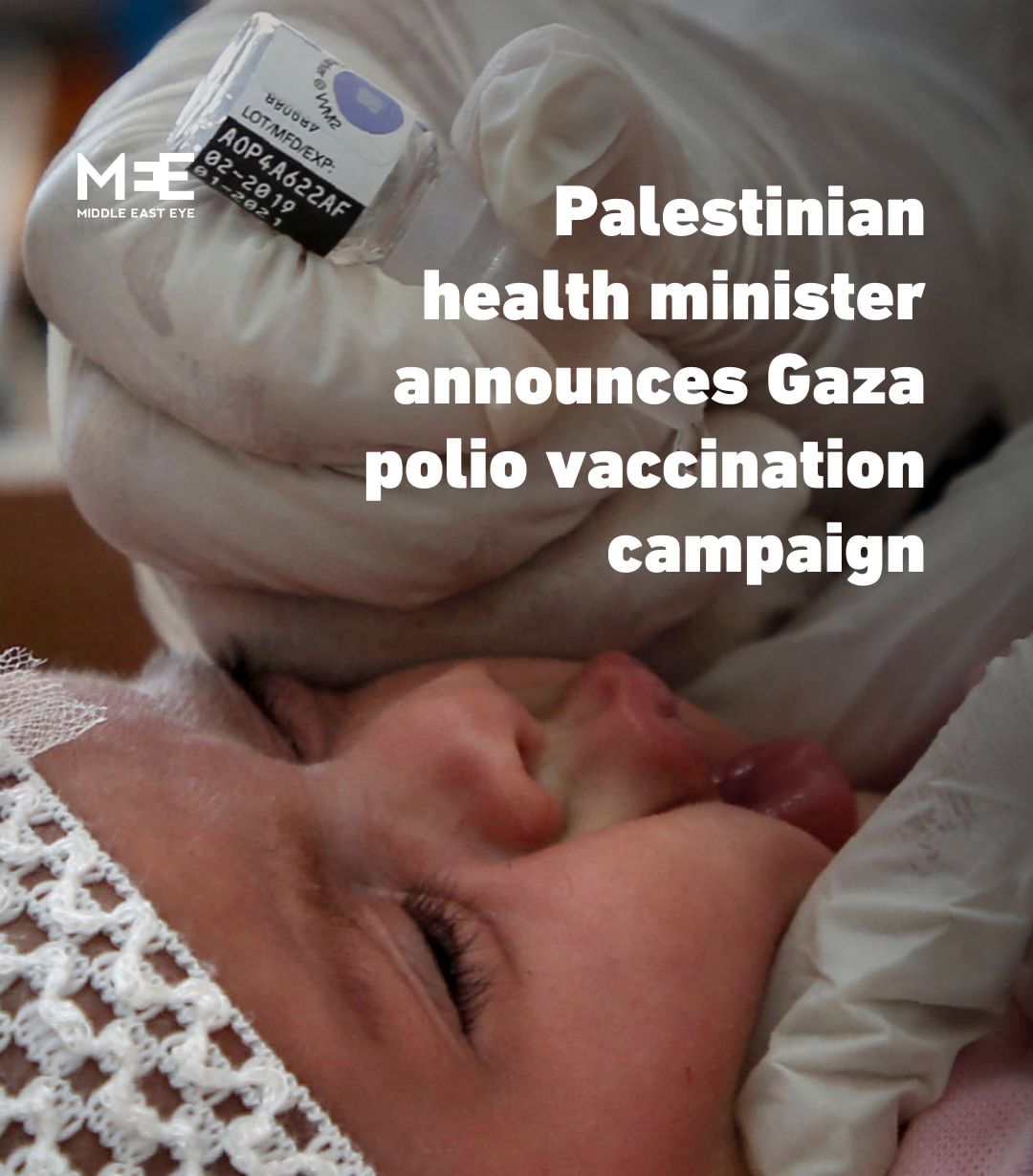 Kampanye Vaksinasi Polio di Jalur Gaza Dimulai Segera