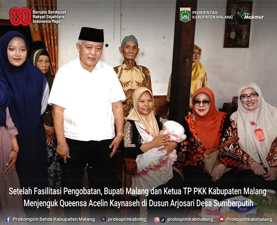 Bupati Malang Kunjungi Bayi Pengidap Hidrosefalus, Harapkan Kesembuhan Total