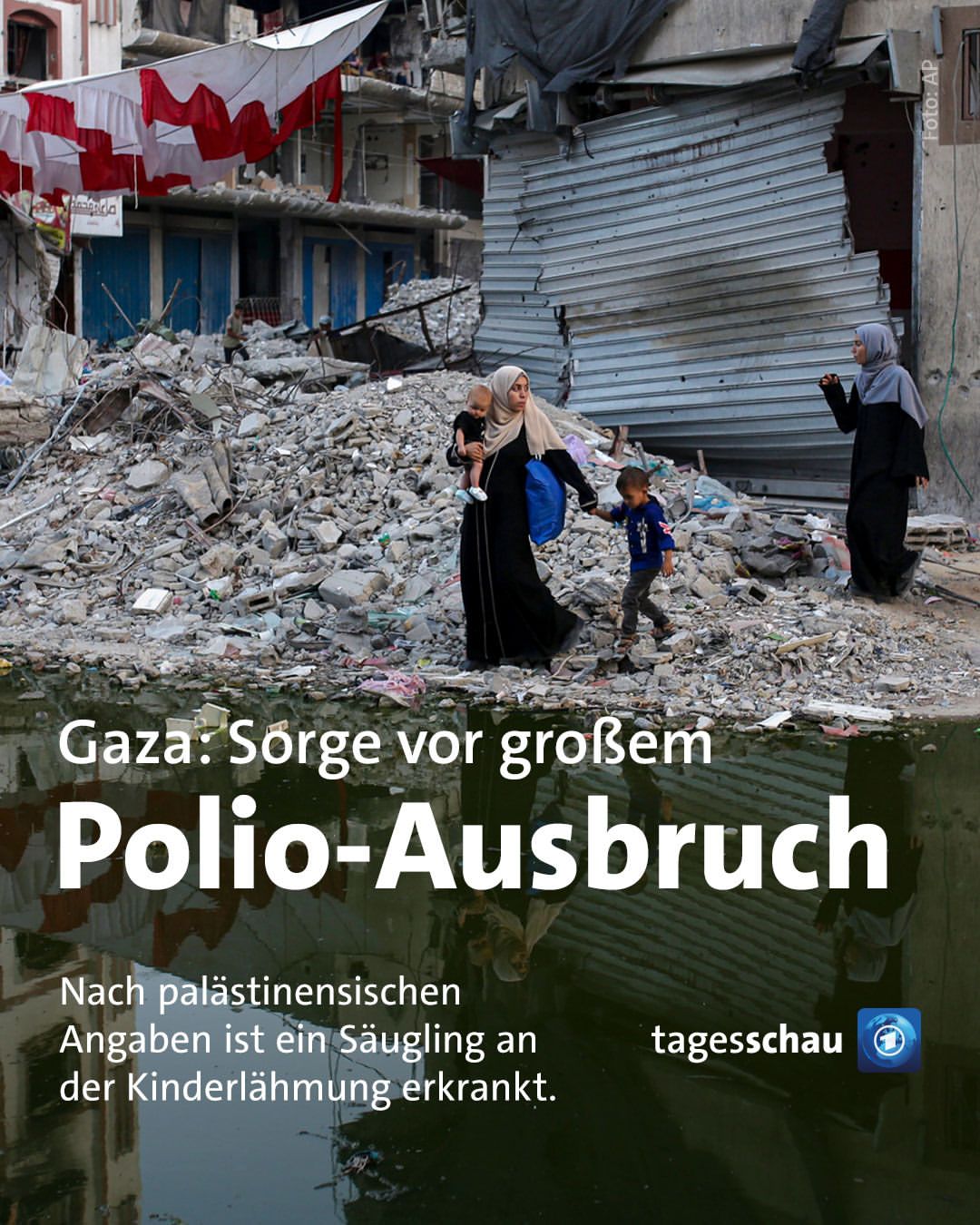 Kondisi Kemanusiaan di Gaza Mencemaskan, Kasus Pertama Polio Tercatat